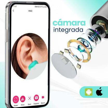 Otoscan Pro- Limpia tus Oídos sin Miedo