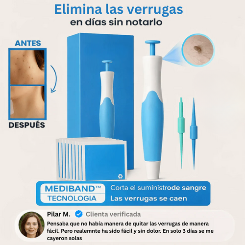 Eliminador Inteligente de Verrugas – Seguro y Preciso