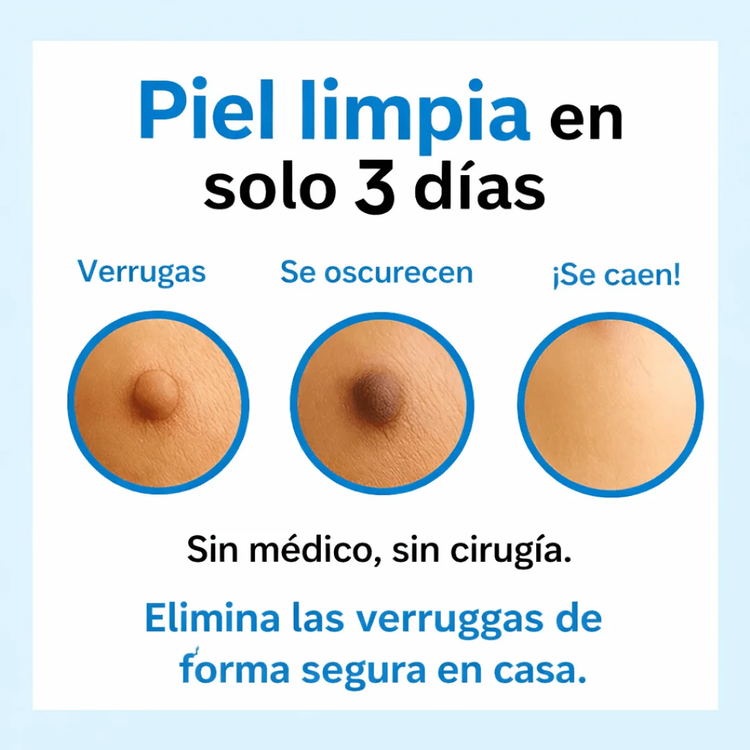 Eliminador Inteligente de Verrugas – Seguro y Preciso