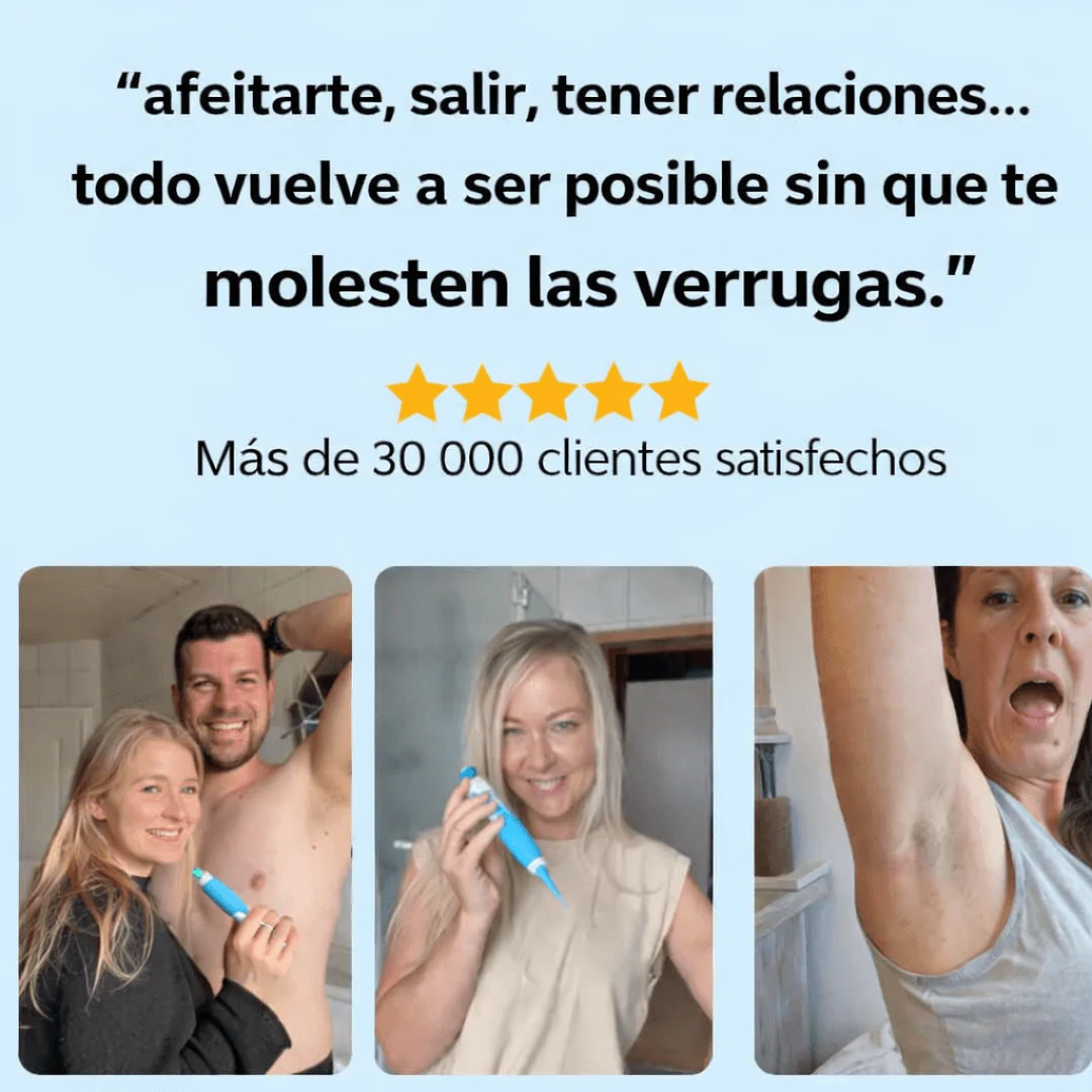 Eliminador Inteligente de Verrugas – Seguro y Preciso